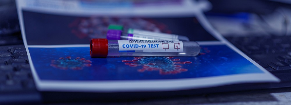 Los positivos por COVID caen hasta los 34 en una jornada con excelentes datos de hospitalización