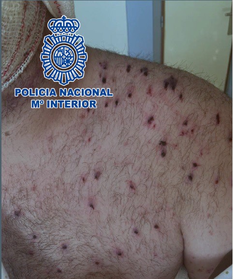 La Policía Nacional detiene al autor de un disparo que estuvo a punto de provocar la muerte de un vecino de Santa María del Águila
