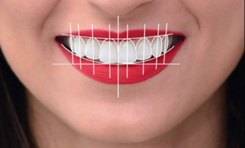 Clínica Dental DSS da la oportunidad de lucir una sonrisa de cine